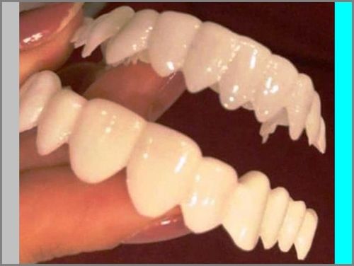 عمر واقعی لمینت دندان واقعا چقدر است