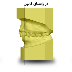 تریم در راستای کانین