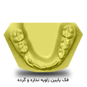 تریم فک پایین