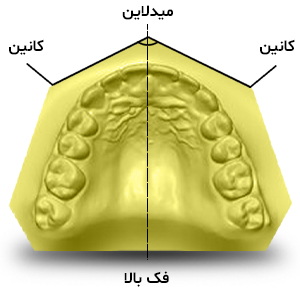تریم کردن فک بالا