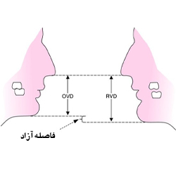فاصله FWS