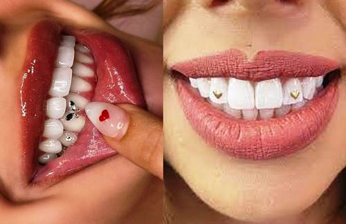 معایب نگین دندان چیت د و چگونه باید استفاده کنید تا مضر نباشید