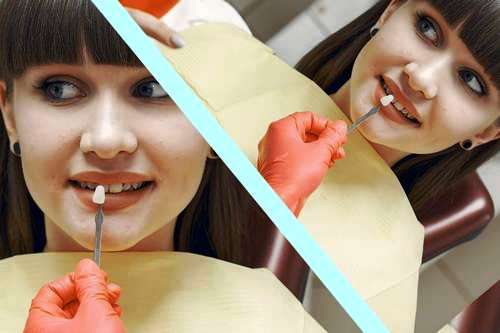 چرا لمینت دندان تعویض  میشود 
