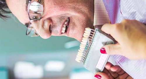 معایب و عوارض لمینت دندان چیست