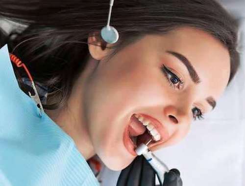 کاربردهای روکش لمینت دندان